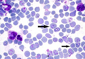 Babesia canis in the red blood cells of a dog