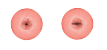 Cervix before (left) and after vaginal birth (right) Cervix birth.png