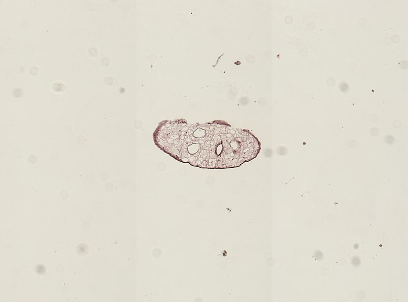 File:Dicrocoelium dendriticum (YPM IZ 094338).jpeg