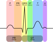 Courbe représentant l'activité cardiaque.