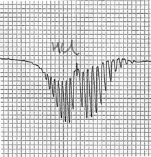 HCl rotiational spectrum.jpg