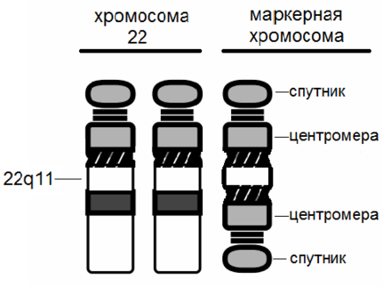 Синдром Кошачьего Глаза Фото