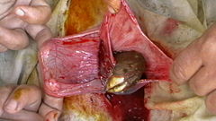 Leg of fetal lamb appearing out of the uterus during caesarian section.