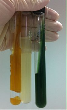 Stab Cultures after inoculation by inoculation needle with E. coli from left to right: TSI, Soft nutrient, Simmons Citrate agar Stab cultures.jpg