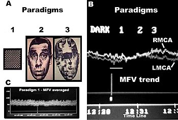 Facial Paradigms TCD Spectroscopy Paradigms.jpg