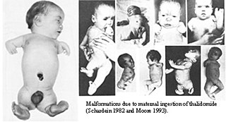 Thalidomide scandal Medical condition