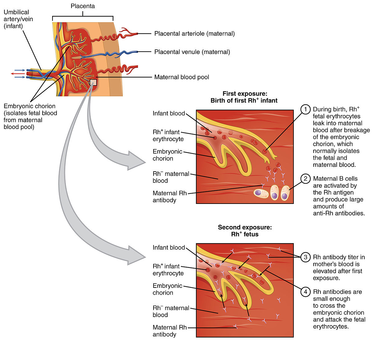 hemolytic disease of the newborn blood smear