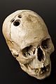 Bronze Age skull from Jericho, Palestine, 2200-2000 Wellcome L0058402.jpg
