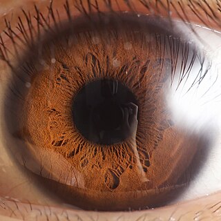 <span class="mw-page-title-main">Iris (anatomy)</span> Colored part of an eye
