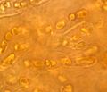 ಫೈರೆನೋಕೊಲೆಮ್ಮ ಹ್ಯಾಲೊಡೈಟ್ಸ್ ಕಲ್ಲುಹೂವಿನಲ್ಲಿ ಶಿಲೀಂಧ್ರಜಾಲದ ಎಳೆಗಳೊಂದಿಗೆ ಇರುವ ಸಯನೋಬ್ಯಾಕ್ಟೀರಿಯಂ ಹೈಲಾ ಸೀಸ್ಪಿಟೊಸ