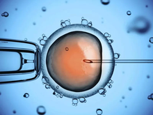 Visualización de una inyección intracitoplasmática de espermatozoides. El proceso en el que un espermatozoide es inyectado a un óvulo.