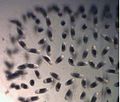Chironomidae spawn