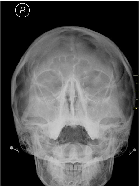 File:Medical X-Ray imaging QUG06 nevit.jpg