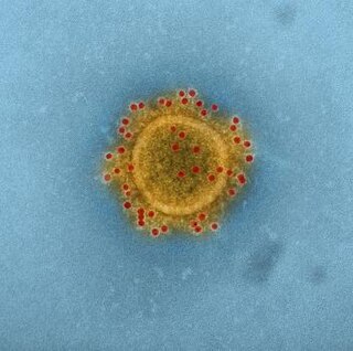 <span class="mw-page-title-main">MERS coronavirus EMC/2012</span> Strain of Middle East respiratory syndrome-related coronavirus