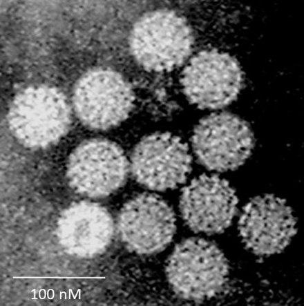 Папиломы вирус передается от человека к человеку. Вирус папилломы под микроскопом. Папилломавирус ВПЧ под микроскопом. Папилломавирусы вирусы. Вирус ВПЧ под микроскопом.