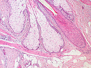 Base of Pilosebaceous Unit 10x.JPG