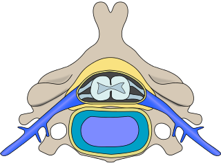 Tvärsnitt av en ryggkota. Ryggsidan (dorsalsidan) är uppåt i bilden. I mitten syns ryggmärgen. 