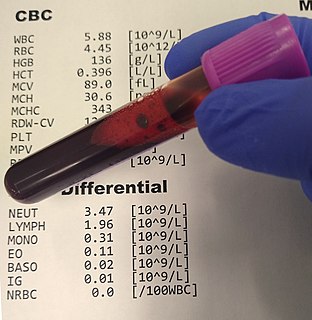 Complete blood count Routine laboratory test of blood cells