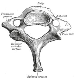 ligamentum nuchae calcification