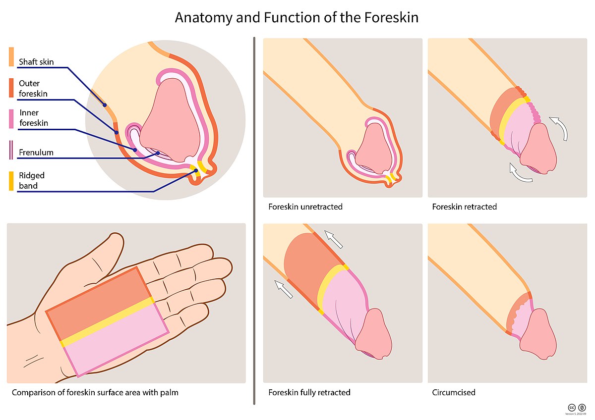 Foreskin pic picture