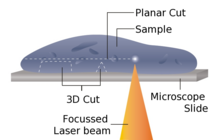 A conceptual diagram of laser microtome operation Laser-microtome-schematic.png