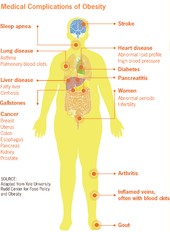 Diagram of the medical complications of obesity, from the US CDC Medical complications of obesity.png