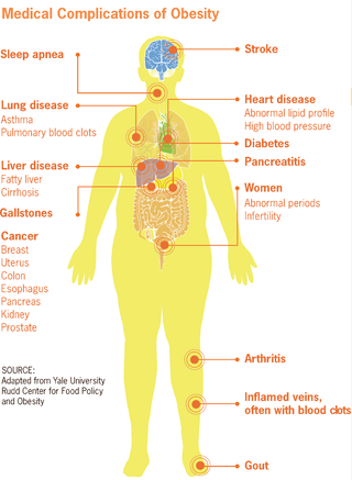 <span class="mw-page-title-main">Obesity-associated morbidity</span> Medical condition