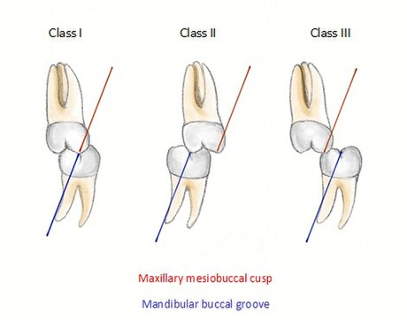 File:Molar relationship.jpg