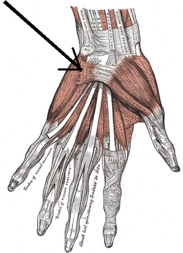 Musculus palmaris brevis