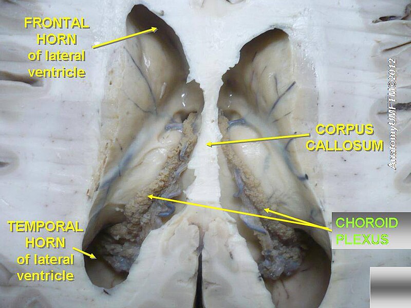 File:Slide3oo.JPG