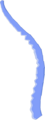 Vertebral fracture - Compression of the vertebrae