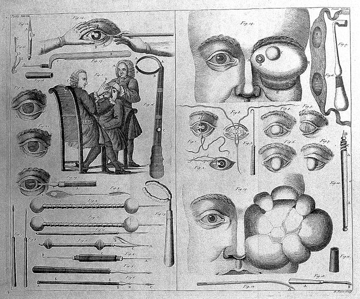 File:A double sheet showing various ophthalmology instruments, ey Wellcome L0012087.jpg