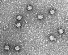 Bacteriophage Phi X 174 Electron micrograph.gif
