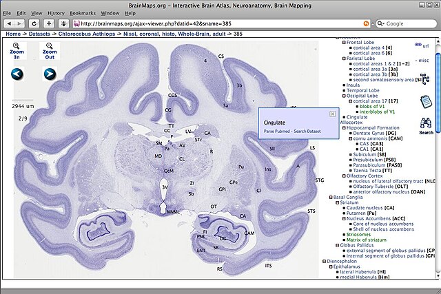 Brain Atlas' Charts How We Navigate Language – National Geographic