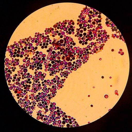 Según un estudio un extracto acuoso de la corteza del jobo puede combatir la candidiasis. 