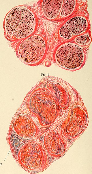 File:Diseases of the nervous system (1910) (14586524238).jpg