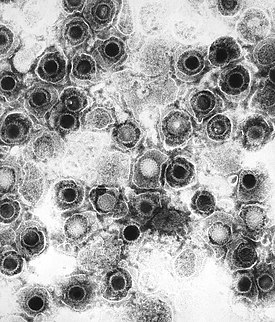 Herpes simplex -viruksia elektronimikroskooppikuvassa