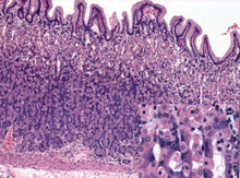 Histology of normal fundic mucosa. Fundic glands are simple, branched tubular glands that extend from the bottom of the gastric pits to the muscularis mucosae; the more distinctive cells are parietal cells. H&E stain. Histology of normal fundic mucosa.png