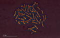 Human karyotype (263 19) Karyotype Human 45,XY t1-17 (mosaic).jpg