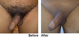 Male Waxing