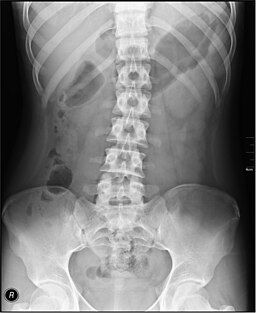 Medical X-Ray imaging ALP02 nevit