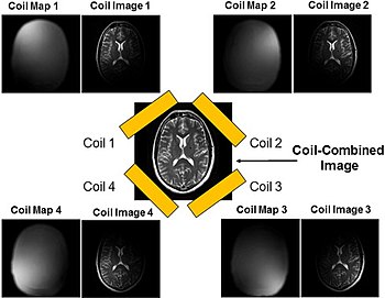 Parallel imaging coil collection Parallel Imaging Coil Collection.jpg