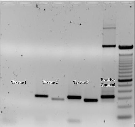 Ethidium bromide-stained PCR products after gel electrophoresis. Two sets of primers were used to amplify a target sequence from three different tissue samples. No amplification is present in sample #1; DNA bands in sample #2 and #3 indicate successful amplification of the target sequence. The gel also shows a positive control, and a DNA ladder containing DNA fragments of defined length for sizing the bands in the experimental PCRs.
