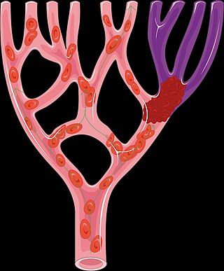 <span class="mw-page-title-main">Alteplase</span> Thrombolytic medication