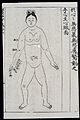 Acupuncture prohibitions for pregnancy, Chinese-Japanese Wellcome L0039988.jpg