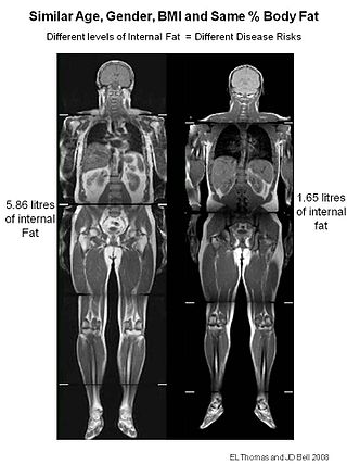 <span class="mw-page-title-main">TOFI</span> Individual with disproportionate amount of fat