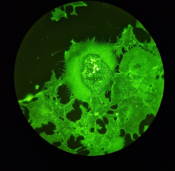 File:Fluorescence.microscope3.jpg