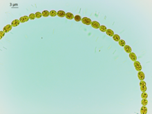 Anabaena sp. Necklace of Mermaid.tif