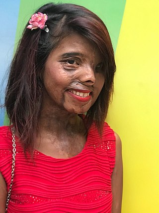 <span class="mw-page-title-main">Anmol Rodriguez</span> Indian acid attack survivor (born 1994)