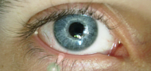 220px-Blue_eye_Stephen.png